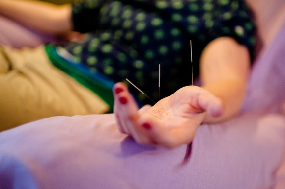 Acupuncture needles are the width of two human hairs. 